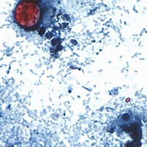 No cyclospora outbreaks reported or tainted lettuce sold in Canada, officials say
