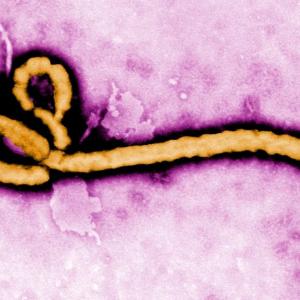 One person with recent travel to East Africa being tested for Ebola virus in Ontario