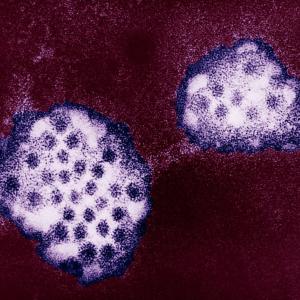 Ontario public health unit warns of infectious stomach illness uptick