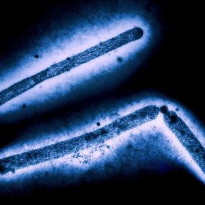 Osivax receives $19.5 million BARDA support for universal flu vaccine candidate