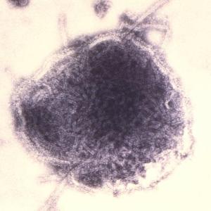 Ottawa Public Health warns of more potential measles exposures