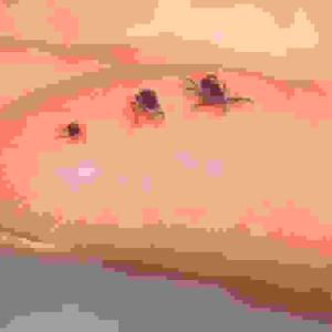 P.E.I. health-care providers now required to report 2 more communicable diseases