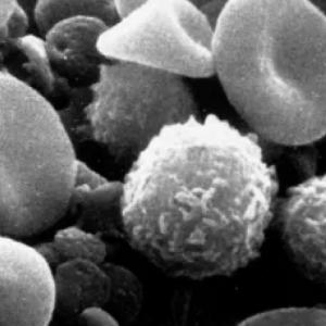 Plan for a world of post-COVID immune effects