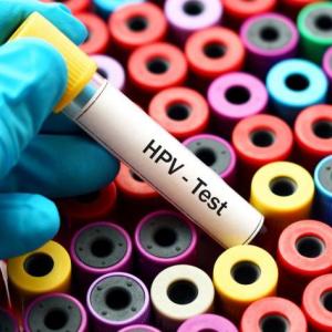 Preliminary study suggests using menstrual blood to screen for HPV