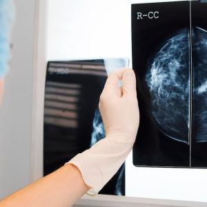 Province expanding free breast cancer screening to Albertans 40 and over