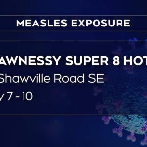 Public alert for measles exposure in Calgary issued by province