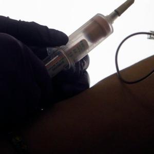 Routine blood tests may help detect PTSD's hidden physical toll, new study finds