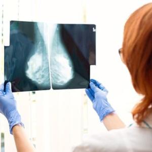 Simple blood test can predict which breast cancer treatment will work best, study finds