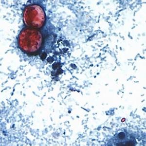 Source of U.S. diarrhea-causing outbreak back in question after FDA declares false positive