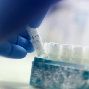 Sperm cells are at their highest quality during summer, study finds