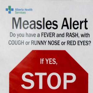 'Standing' Alberta measles exposure alerts now include Parkland County