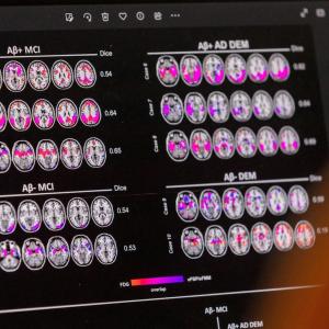 The challenge of whether to fund promising new drugs