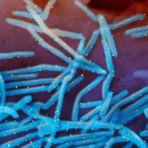 ‘The kids of Alberta deserve it’: Pediatricians seek universal coverage for RSV shots