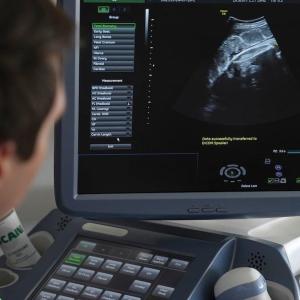 Toronto researchers use AI to tackle endometriosis diagnostic delays