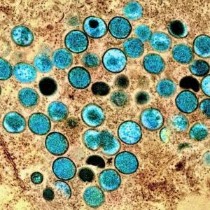 Tpoxx should no longer be used to treat mpox, European drug regulators say