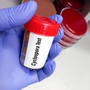 Trump's deep public health cuts hinder response to record US cyclosporiasis outbreak
