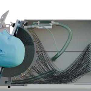 Ultrasound 'helmet' could treat Parkinson's non-invasively, study shows