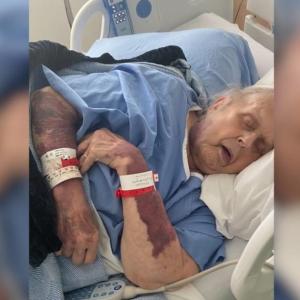 Watchdog calls on Toronto hospital to remove ‘militaristic’ language from security policies after elderly patient injured