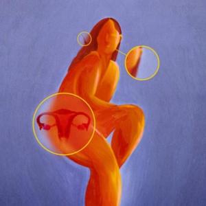 What is PCOS, what are the symptoms and treatment, and why is it being renamed PMOS?