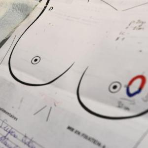 Why do pregnancy, breastfeeding reduce risk of breast cancer? Latest science finds clues