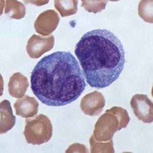Why scientists are rethinking the immune effects of SARS-CoV-2