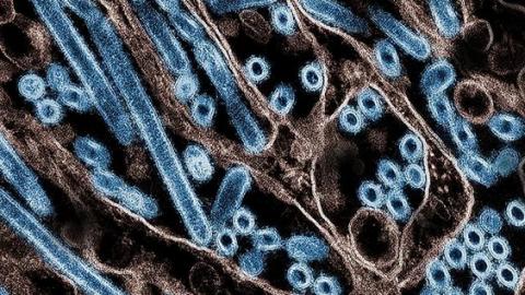 Canada must step up as the global leader in pandemic preparedness