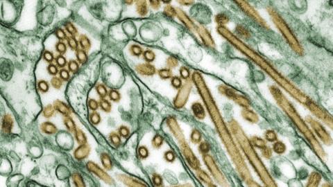 Mexico confirms country's first human case of bird flu in a 3-year-old girl