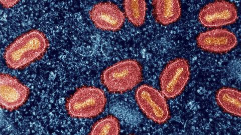 UK reports clade 1b mpox case with no travel history or links to earlier cases