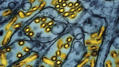 Mexico says a 3-year-old girl has died in the country's first human case of bird flu
