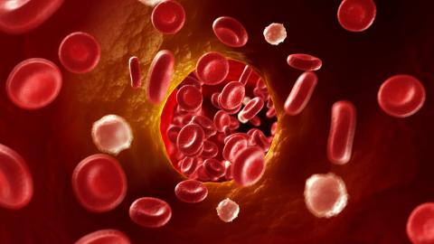 Gene-editing therapy lowers cholesterol without serious side effects in early study