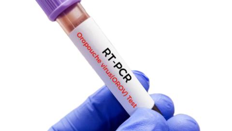 Study shows Oropouche virus may be more widespread than previously thought