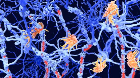 ‘Inverse vaccines’: the promise of a ‘holy grail’ treatment for autoimmune diseases