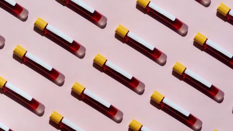 Is in-depth and expensive blood work worth it?