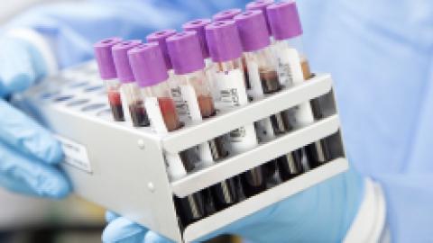 Your Blood Predicts Alzheimer's Disease