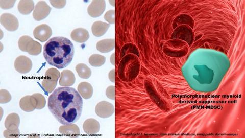 SARS-CoV-2 'reprograms' immune cells into immune system suppressors, study shows