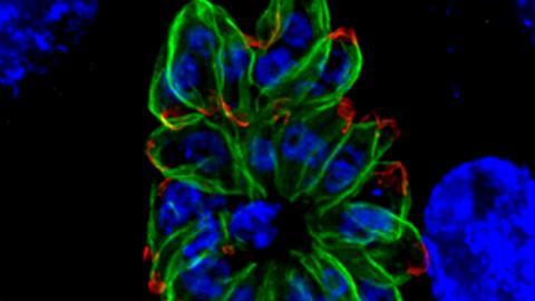 A common parasite can decapitate human sperm — with implications for male fertility