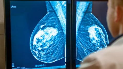 Key takeaways from world's largest cancer conference in Chicago