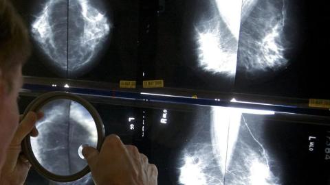 Health screening task force to relaunch next spring after report calls for reform
