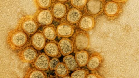 New COVID variant swiftly gains ground in US; summer wave looms