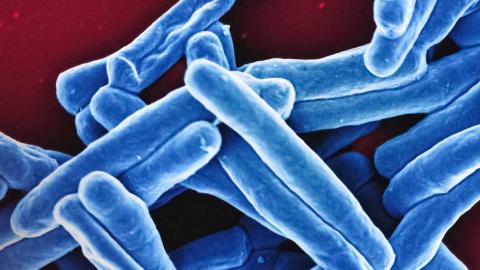 How new vaccines could revolutionise our relationship with tuberculosis