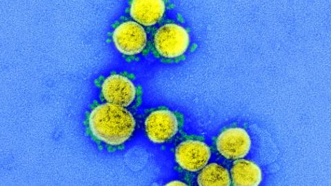 WHO adds XFG to SARS-CoV-2 variants under monitoring