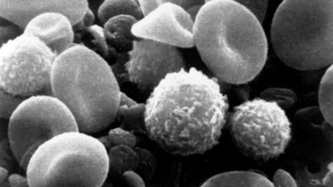 Plan for a world of post-COVID immune effects