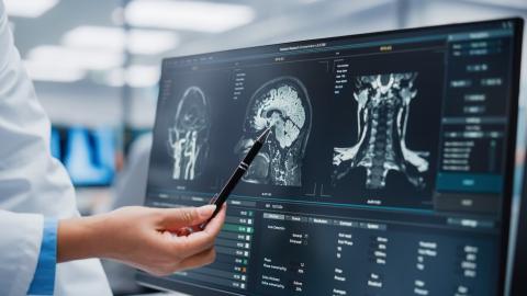 Long COVID Brain Fog Isn’t “All in Your Head.” Scientists Now Know the Cause.
