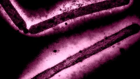 Preliminary case of bird flu in Washington state would be U.S.'s first reported infection in 9 months