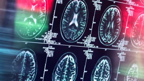 Antidepressants and antipsychotics could serve as alternatives to opioids, study finds