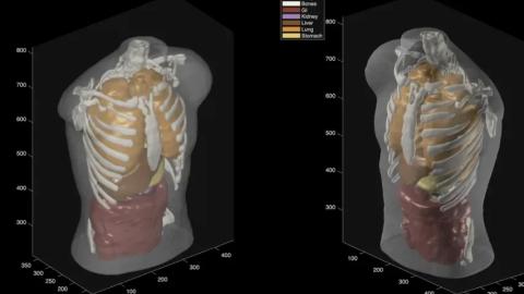Midjourney goes from generating cat images to full-body ultrasound scans