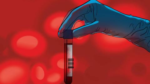 A blood test that screens for multiple types of cancer? It may be available soon