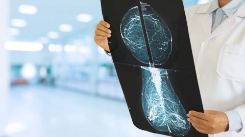 Canadian study suggests less breast cancer treatment may be just as effective, with fewer side-effects