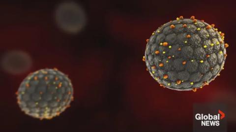 Hantavirus self-isolation complete for 34 Canadians, Health Canada says