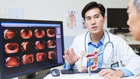 Ontario Docs to Screen Younger Patients for Colon Cancer